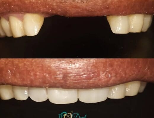 Consultorio Dental Dra. Ismelis Polanco IPA